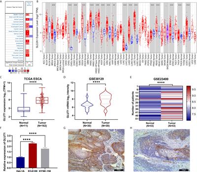 Comprehensive Analysis of GLUT1 Immune Infiltrates and ceRNA Network in Human Esophageal Carcinoma